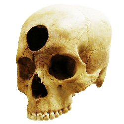 Peruvian Skull, c.2,000 BP.
